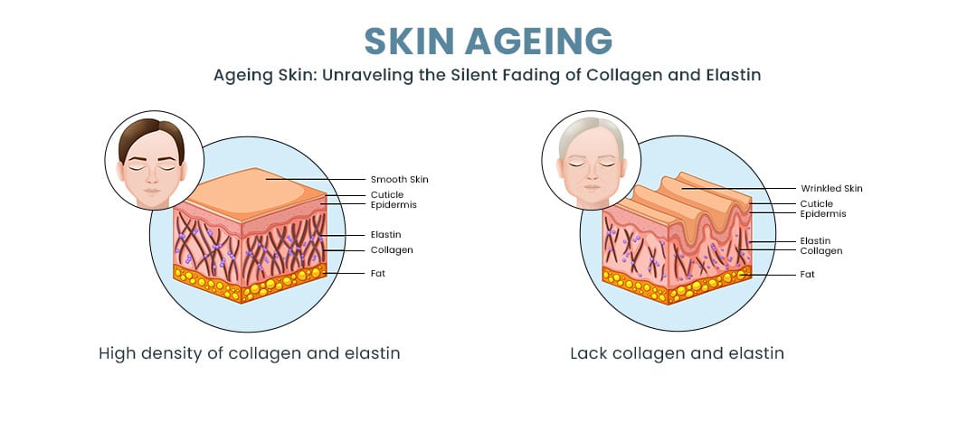Skin aging infographic comparing young and aged skin showing collagen and elastin loss