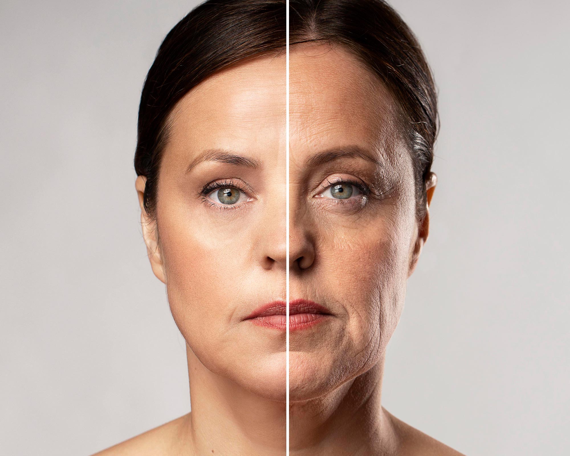 Before and after face image showing visible anti-aging treatment results