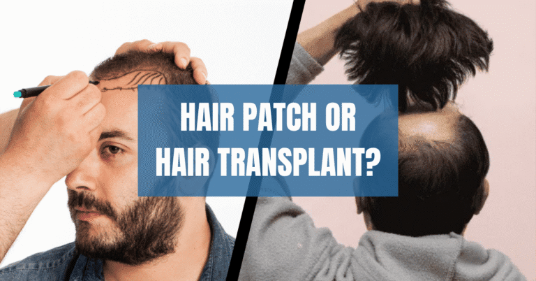 Hair Patch or Hair Transplant? Honest Comparison, Prices & Long-Term Results Explained